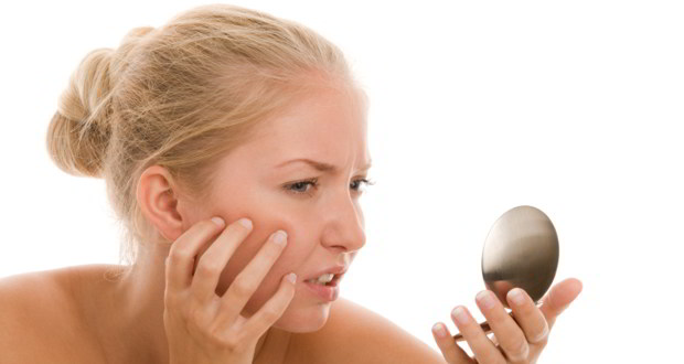natural acne remedies
