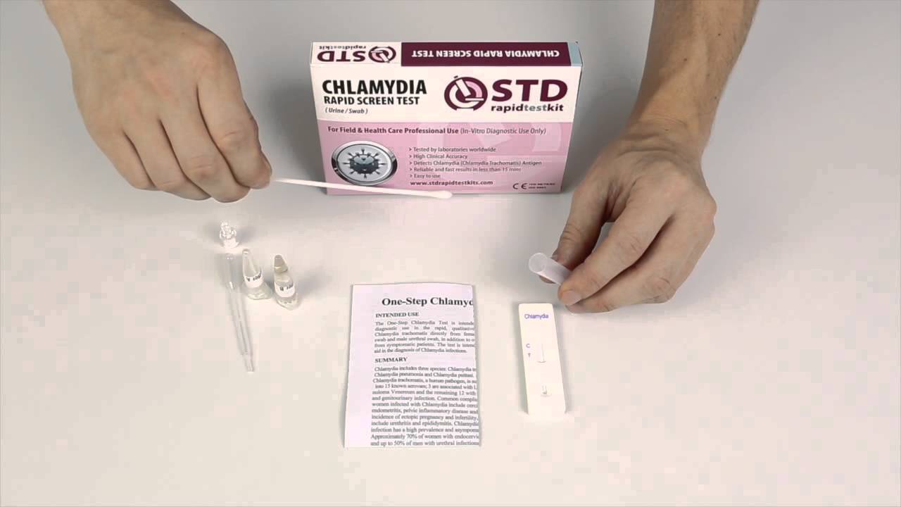 chlamydia test