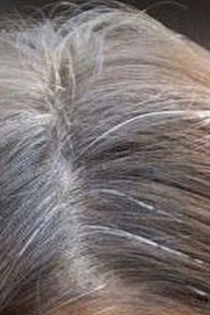 gray_hair