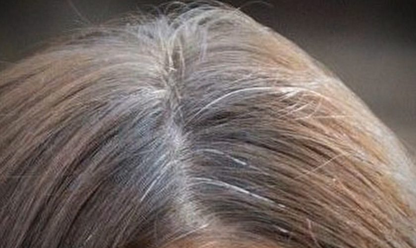 gray_hair