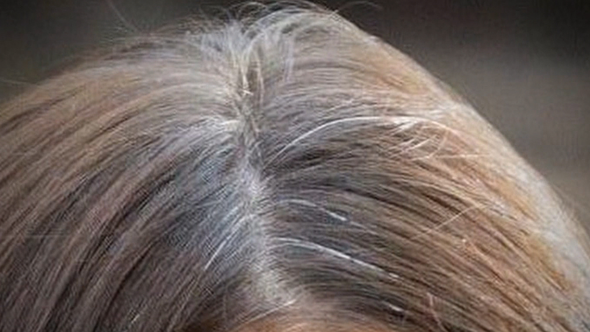 Premature Gray Hair Medical Problems Find Home Remedies